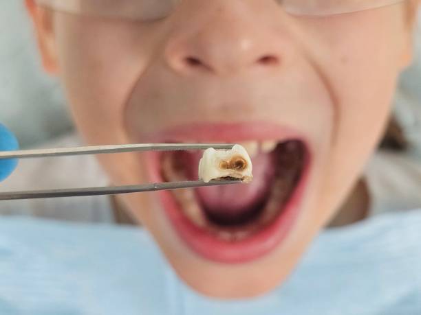 Best Pediatric Emergency Dentist in Providence, RI